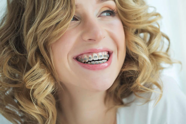 Braces Work at Any Age: Debunking the Myth and Exploring Modern Adult Orthodontics