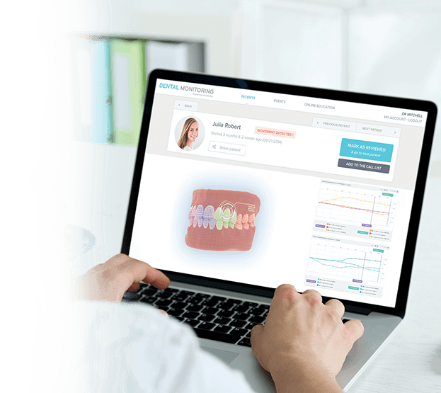  Virtual check-ups with Dental Monitoring