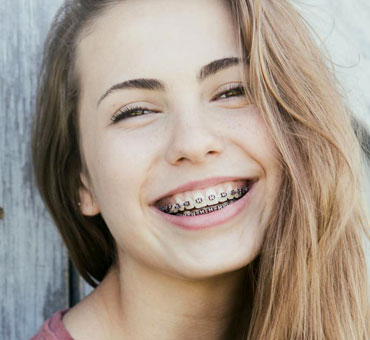 Types of braces