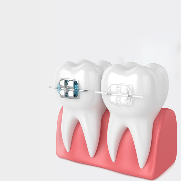 Costs & Financing, Cost of Braces & Invisalign®